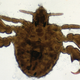 Illustration for article titled Three Things You Probably Didnt Know About Crab Lice